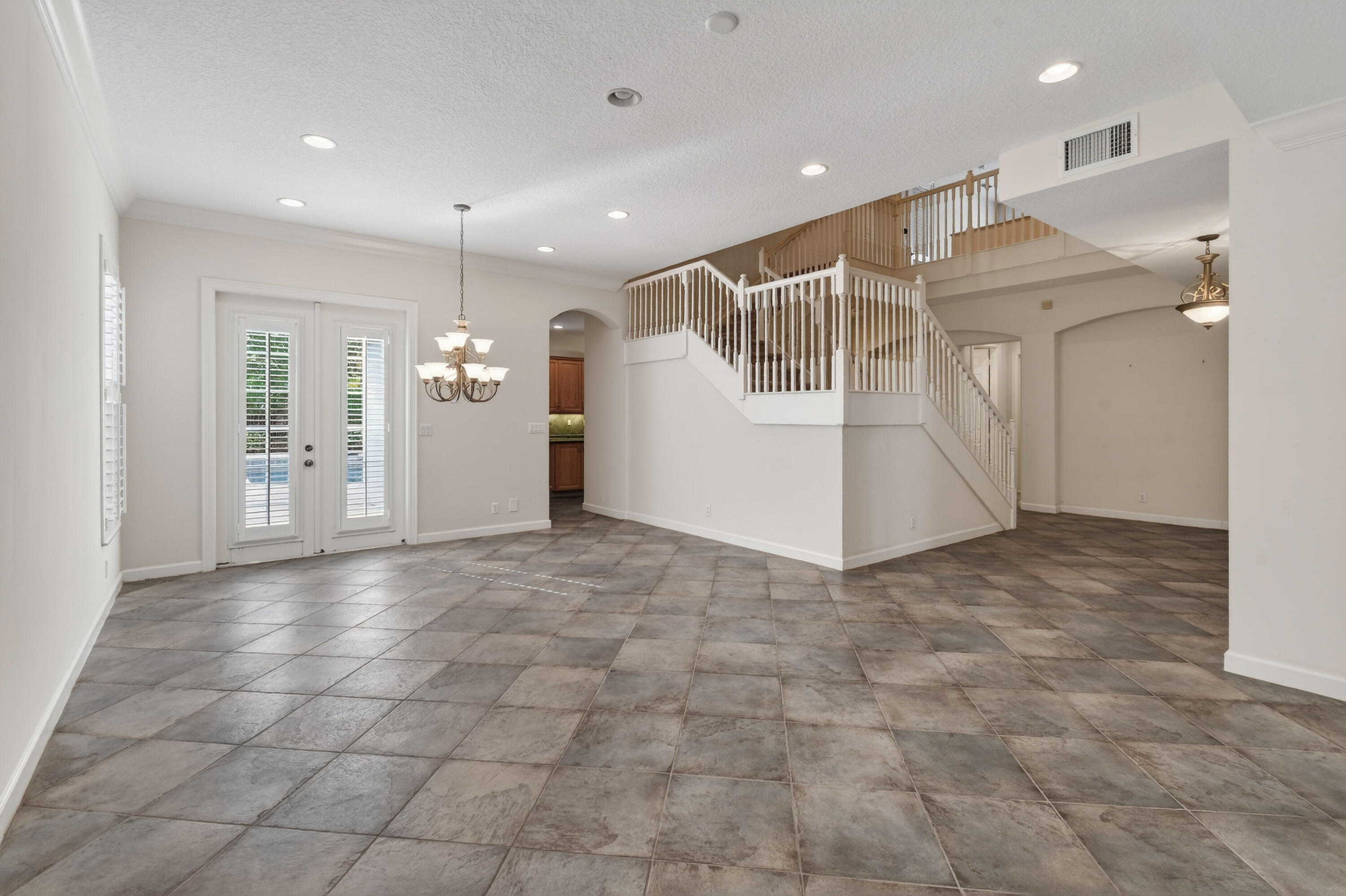 MLS #RX-11148022 image #6